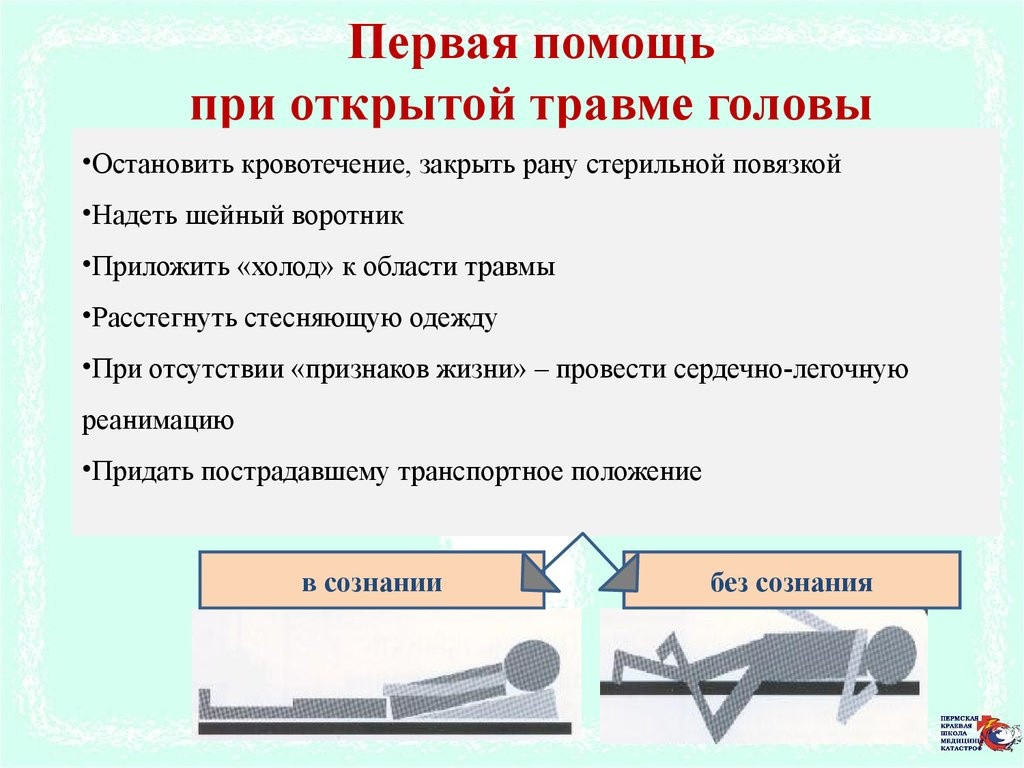 Первая помощь при открытой травме головы | Ретюнское сельское поселение